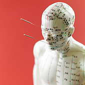 Traditional and Contemporary Acupunctire